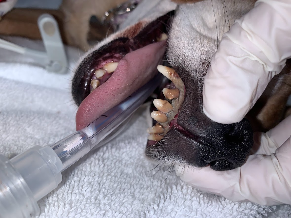 Dental Cleaning - During Procedure
